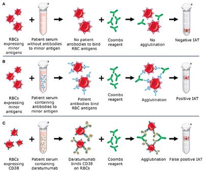 Blood Transfusion Management for Patients Treated With Anti-CD38 Monoclonal Antibodies